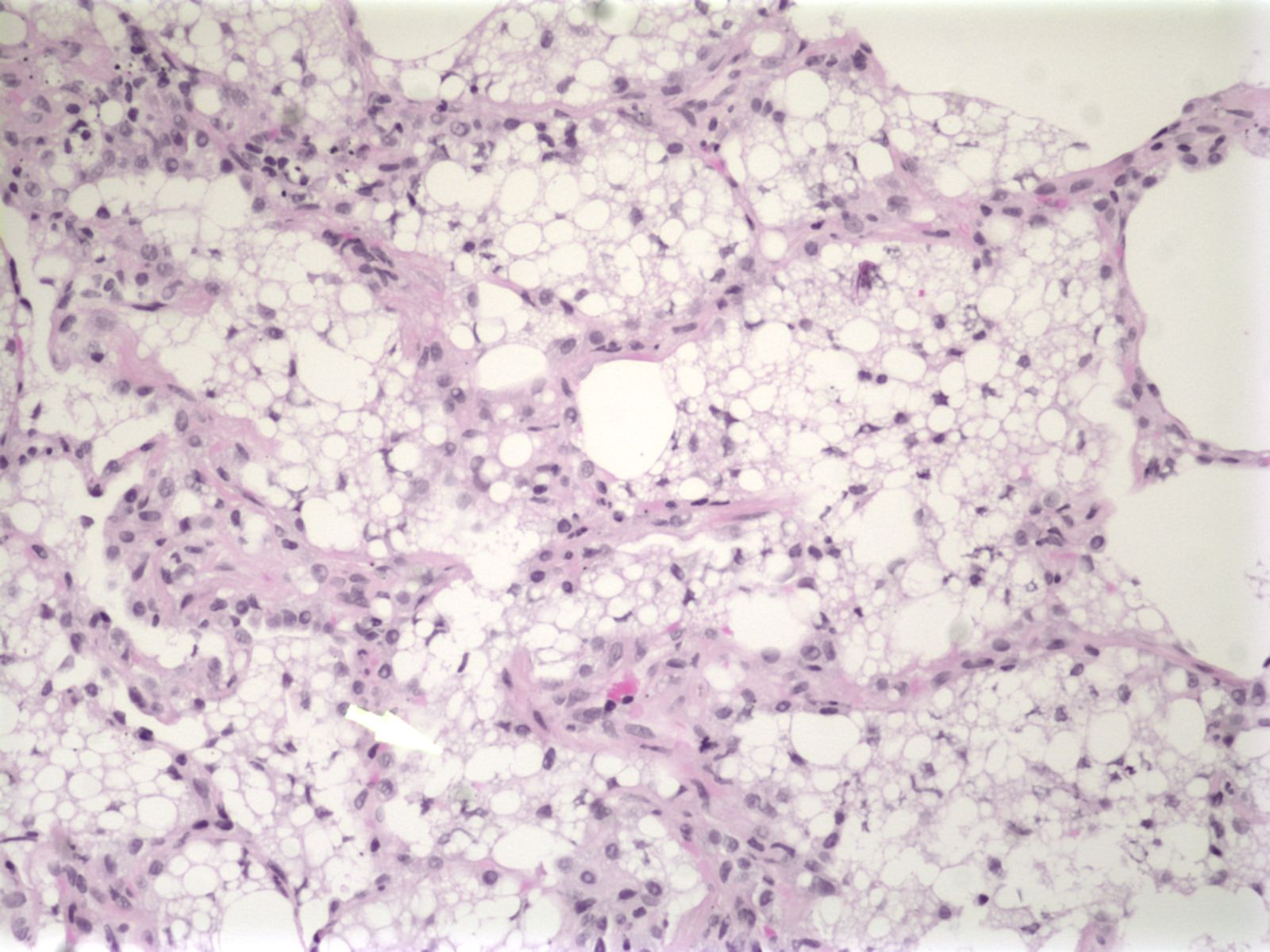 Mystery Quiz 2The Answer Clinical Correlations